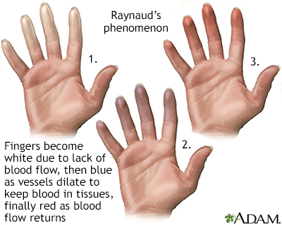 Fingers that change color Information