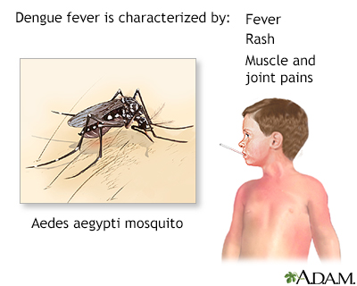 Dengue fever - Illustration Thumbnail
              