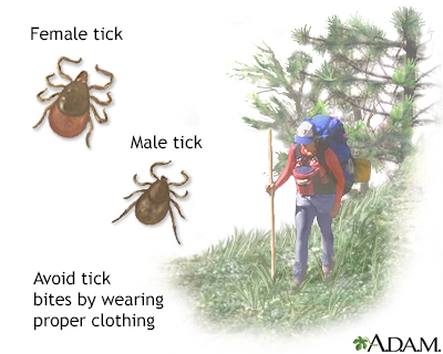 Ehrlichiosis - Illustration Thumbnail
                      