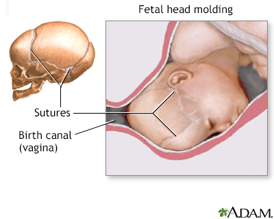 sutures of the fetal skull