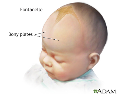 Fontanelles enlarged Information Mount Sinai New York