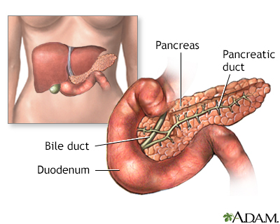 Type 1 Diabetes Mellitus Causes, Symptoms and Complications