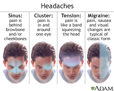 In-Depth Reports - Headaches - tension