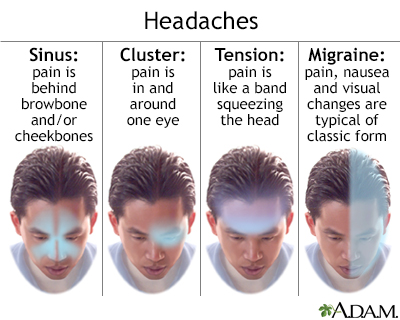 Headache - Illustration Thumbnail
              