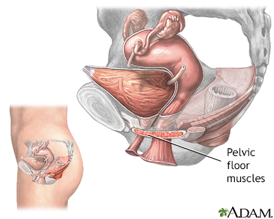 Stress incontinence