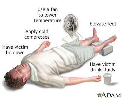 heat emergencies definition aid cramps illnesses temperature body exhaustion types normal when caused someone exposure extreme sun