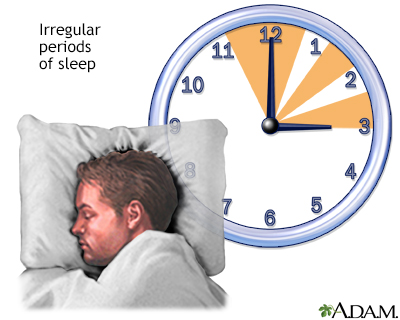 RN Warning: Irregular Sleep Can Be Dangerous