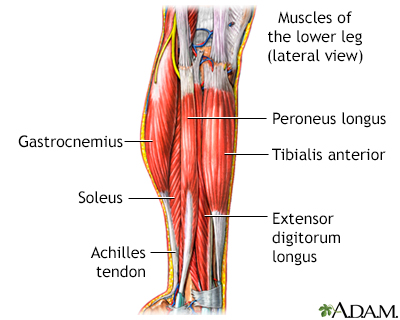 Leg pain Information  Mount Sinai - New York