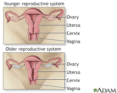 Symptoms and signs of estrogen deficiency and vaginal atrophy 4,8,10