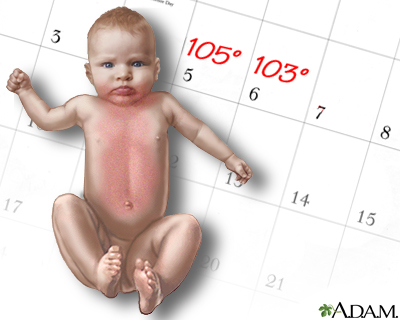 Roseola (Sixth Disease) Symptoms & Causes