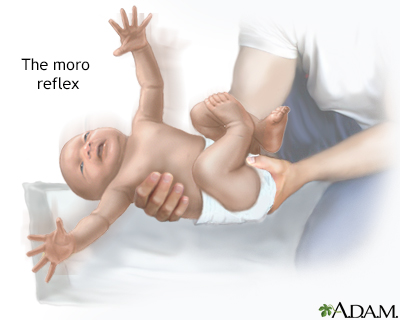 Moro reflex - Illustration Thumbnail
                      