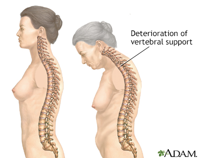 Signs your body is aging faster than you are!