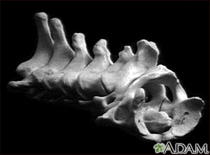 Vertebra, cervical (neck) - Illustration Thumbnail
                      