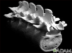 Vertebra, lumbar (low back) - Illustration Thumbnail							