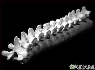 Vertebra, thoracic (mid back)