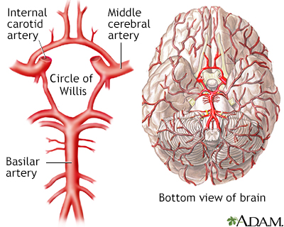 Circle of Willis