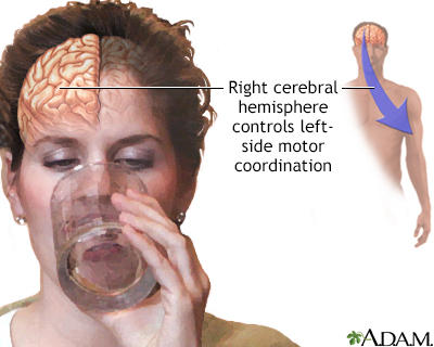 Right cerebral hemisphere - function - Illustration Thumbnail              
