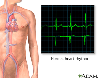 24 hour ECG (Holter) monitoring