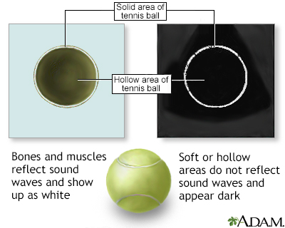 Ultrasound comparison - Illustration Thumbnail
              