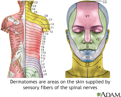 shingles forehead