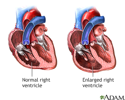 tricuspid valve