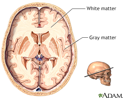 Gray and white matter of the brain - Illustration Thumbnail
              