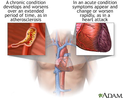 Acute vs. chronic conditions - Illustration Thumbnail
              