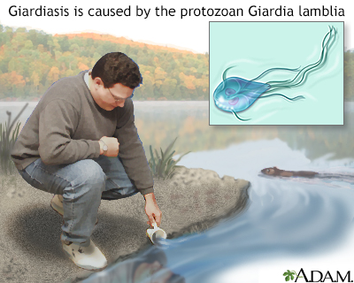 giardiasis water treatment)