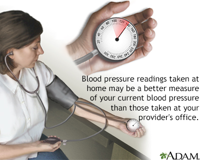 Monitoring blood pressure - Illustration Thumbnail              