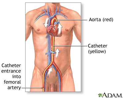 Procedure, part 1