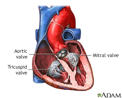 Chirurgie des valves cardiaques - Série