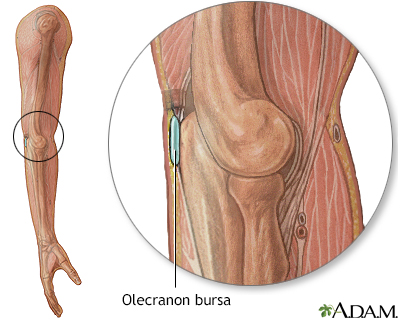 Bursa of the elbow - Illustration Thumbnail
              