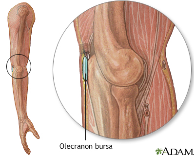 Bursa of the elbow - Illustration Thumbnail
                      