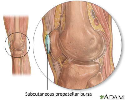 Bursa of the knee - Illustration Thumbnail
              