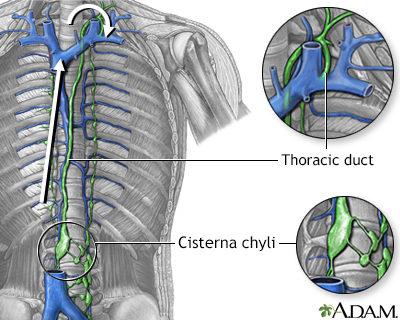 swollen lymph nodes back of neck