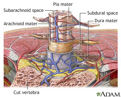 viral meningitis structure