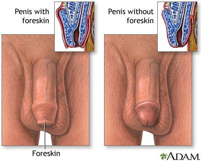 Penis - with and without foreskin - Illustration Thumbnail
                      