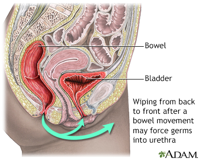 Urinary Tract Infection (UTI) - Symptoms & Causes