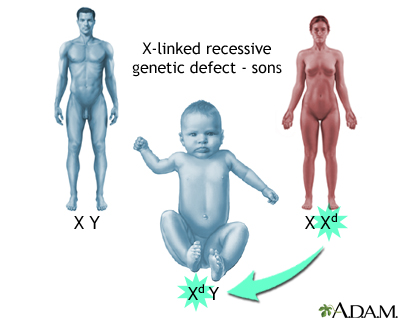 X-linked recessive genetic defects - how boys are affected - Illustration Thumbnail
                      