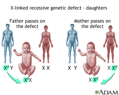 X-linked recessive genetic defects - how girls are affected - Illustration Thumbnail              