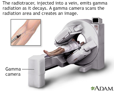 reference tool for cardiac stress test