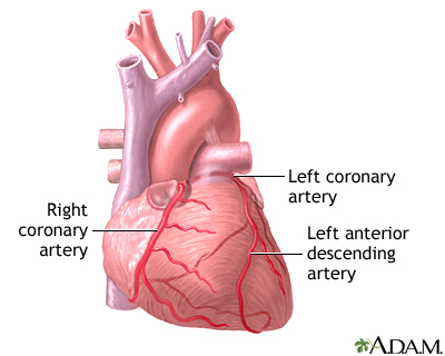 Heart bypass surgery - series - Illustration Thumbnail
              