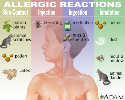 Hie Multimedia Allergies