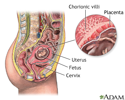 Chorionic villus sampling - normal anatomy - Presentation Thumbnail
                    