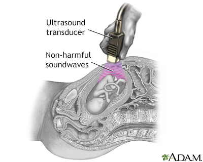 Prenatal ultrasound - series - Procedure, part 2