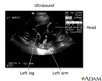 Ultrasound 3