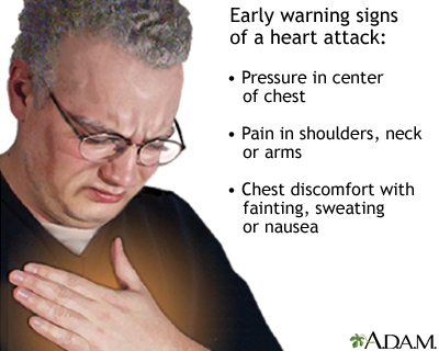 Heart attack symptoms - Illustration Thumbnail
              