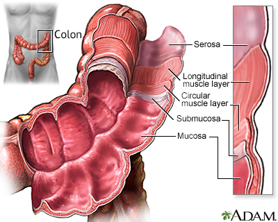 Colon cancer Information