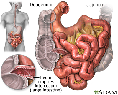 symptoms of small intestine problems