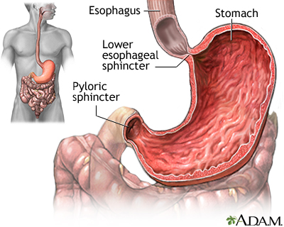 What Is Stomach Cancer? - NCI